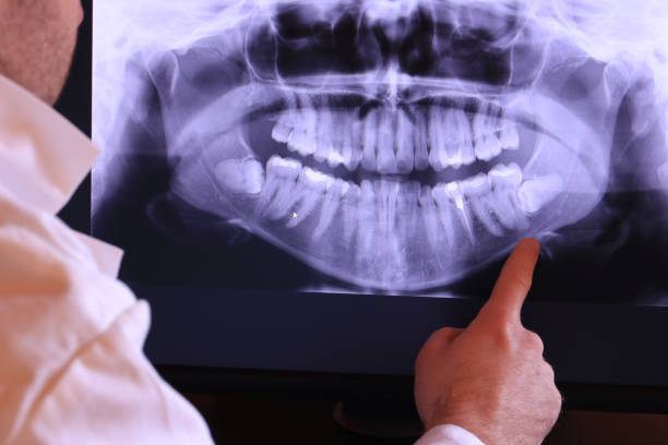 Best Emergency Tooth Extraction in Troy, IL